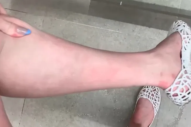 Екатеринбуржцы покрылись сыпью после купания в бассейне в новых термах