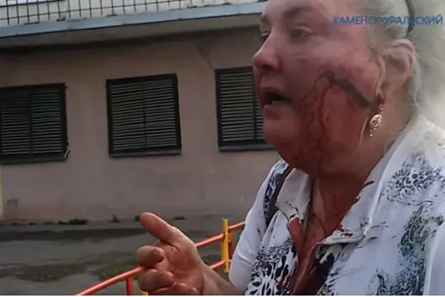 Из отдела полиции увезли окровавленную женщину, обратившуюся туда за помощью