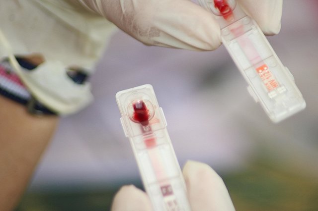 В Екатеринбурге соседка спасла мужчину, умирающего от СПИДа