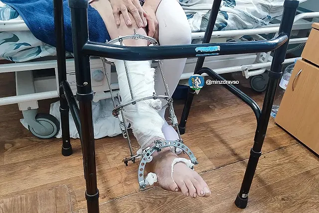 На Урале женщине пришили отрезанную мотоблоком ногу