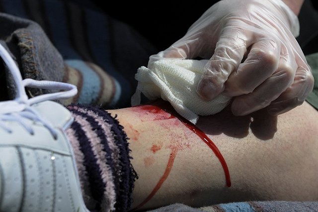 Стали известны подробности поножовщины на Урале, в которой подозревается депутат