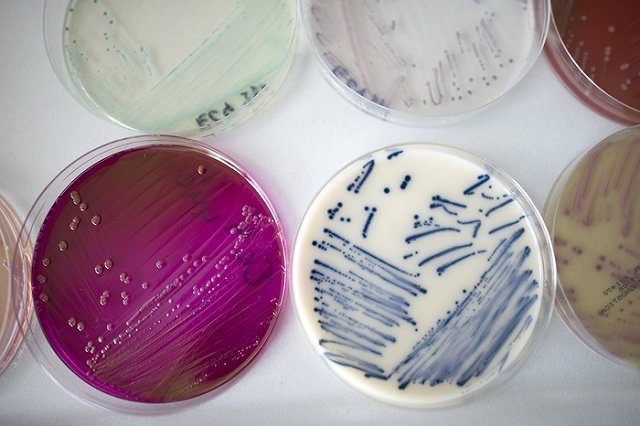 В кишечнике человека нашли средство от старости