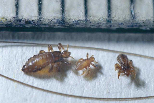 В Екатеринбурге родители сообщили о вспышке педикулеза в детсадах