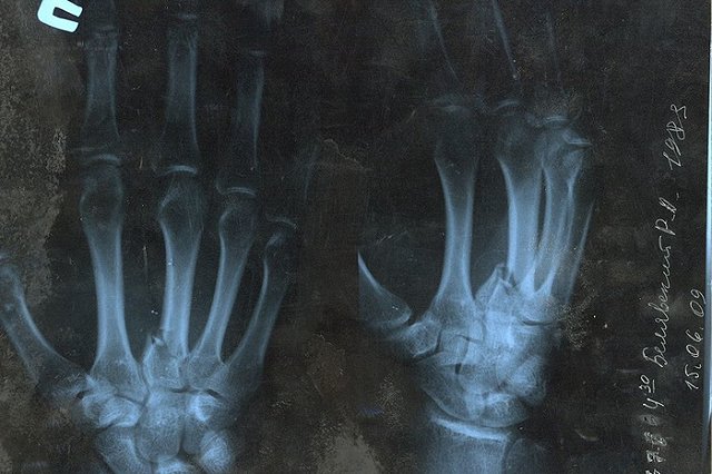 Уральцу грозит до десяти лет колонии за сломанный палец полицейского