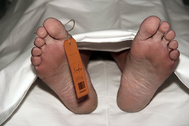 В США в центре биоресурсов сшивали тела из кусков трупов и продавали части тел