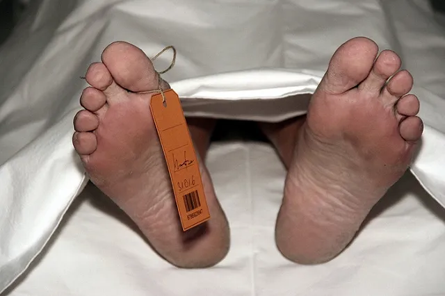 В США в центре биоресурсов сшивали тела из кусков трупов и продавали части тел