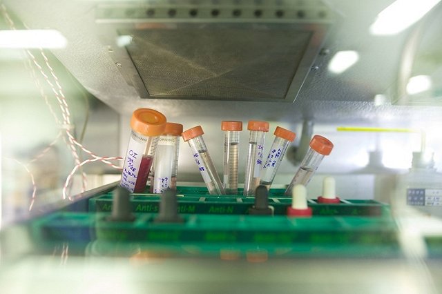 Замглавы горздрава Екатеринбурга заболел коронавирусом