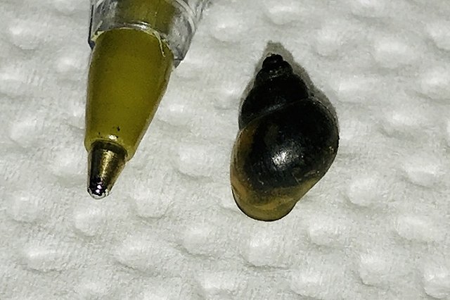 Тюменские медики обнаружили в ухе одного из пациентов живую улитку