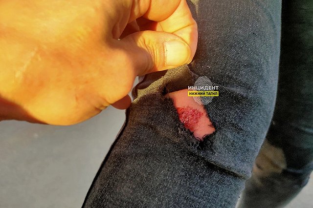 Свердловчанка с ребёнком упала, разодрав ногу. Её муж обвинил в этом магазин