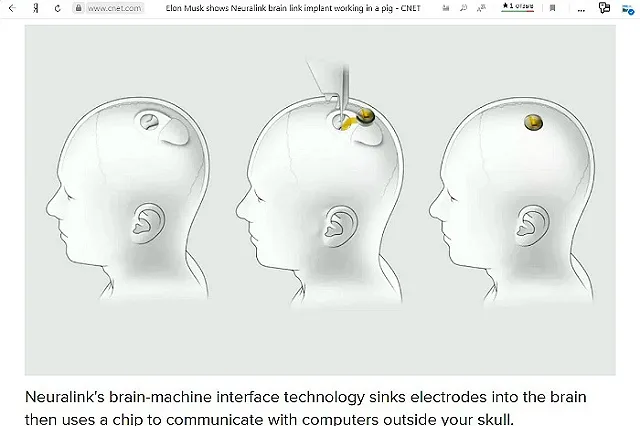 Маск рассказал, как будут вживлять чипы в черепа для подключения мозга к компьютеру