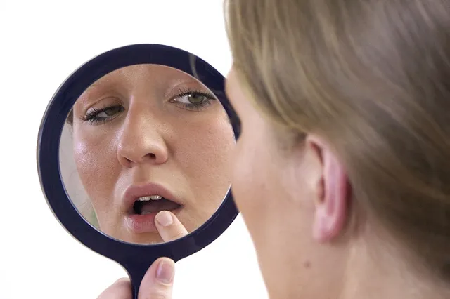 Лекарство от гипертонии победит герпес