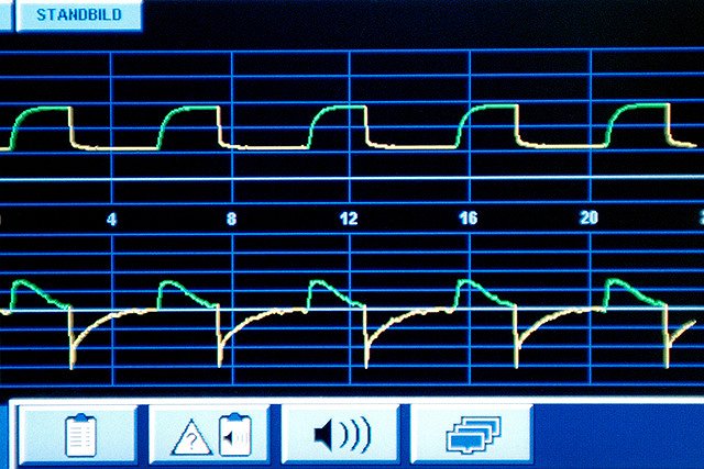 МИД: египетские врачи не отключали россиянина от ИВЛ, пока он не умер