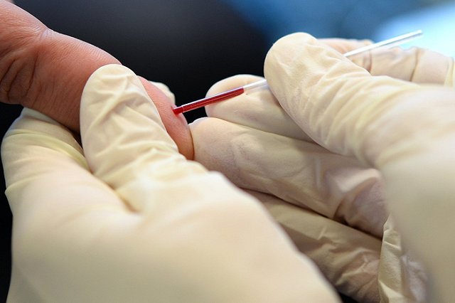 79-летняя екатеринбурженка прошла тест на ВИЧ после незащищенного секса