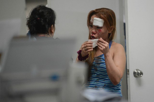 Роспотребнадзор дал рекомендации по выбору пиротехники