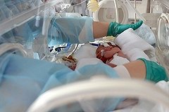 В больнице Качканара двухлетнему ребенку сожгли грелкой ноги