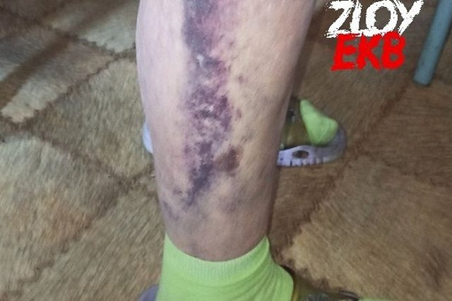 В Екатеринбурга два автомобиля, соперничая за проезд во двор, зажали 93-летнюю пенсионерку