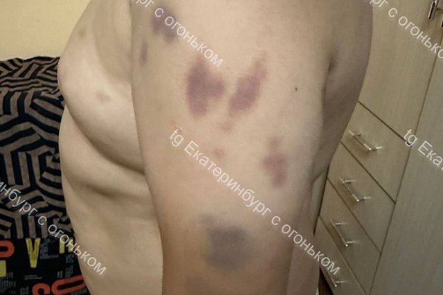 В детском оздоровительном лагере в Свердловской области жестоко избили ребёнка