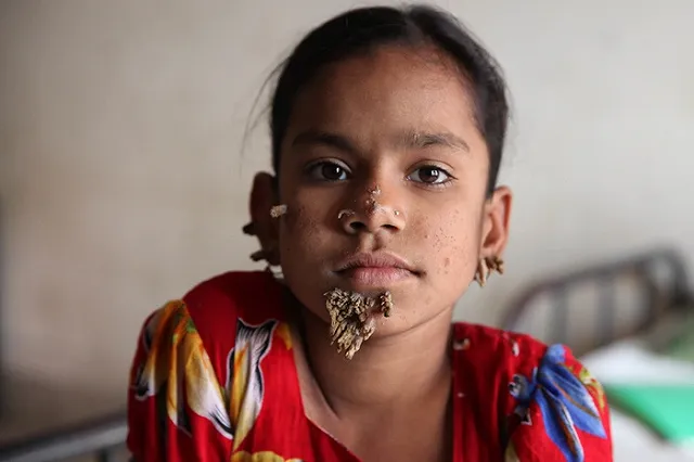 Лиза Пескова призналась, что над ней издевались из-за лица