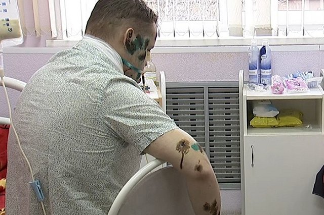 У карпинца, истерзанного медведем, заканчиваются деньги на лечение