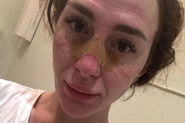 «Температура под 39»: уральский медик с симптомами COVID-19 не может получить медпомощь