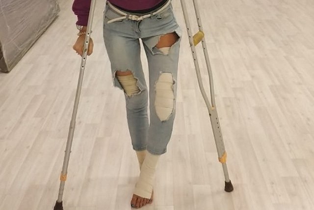 В Екатеринбурге 17-летний водитель сломал девушке-хореографу ноги