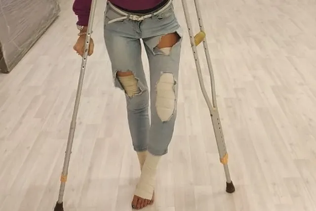 В Екатеринбурге 17-летний водитель сломал девушке-хореографу ноги