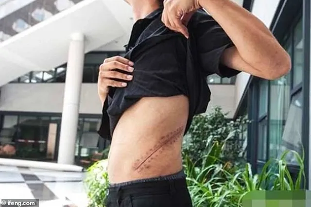 Молодой человек отдал почку за iPhone и остался инвалидом