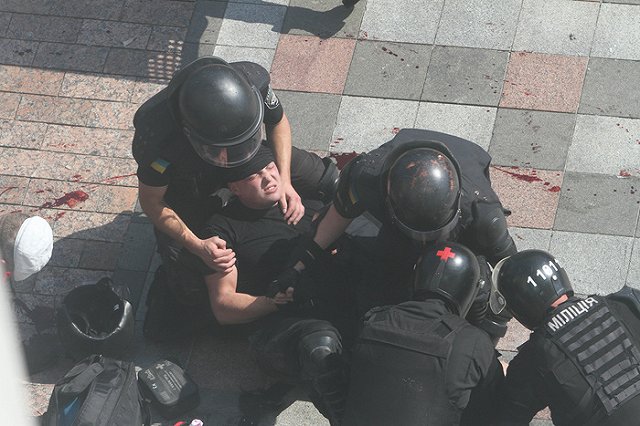 В ходе столкновений в Киеве сотруднице полиции сломали пальцы