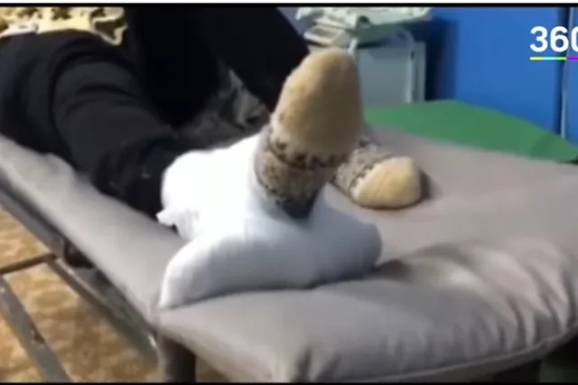 Умерла пенсионерка, которой примотали к сломанной ноге швабру для мытья пола