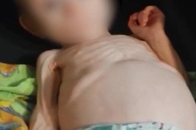 «Пока далеко от нормы»: медики о состоянии девочки из Карпинска, которую мать держала в шкафу