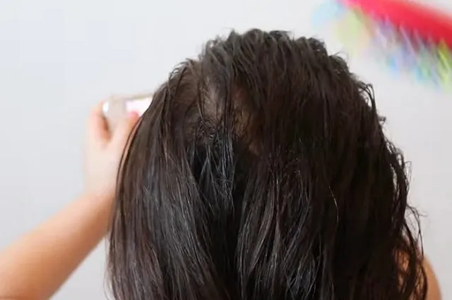 В Подмосковье врачи достали из желудка девушки килограмм волос (ФОТО)