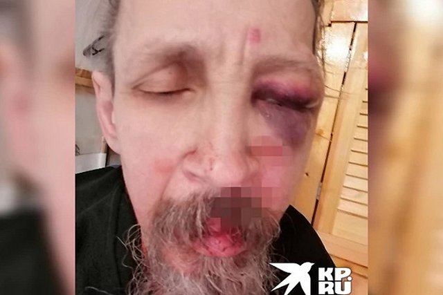 Во дворе дома в Верхней Пышме жестоко избили дворника