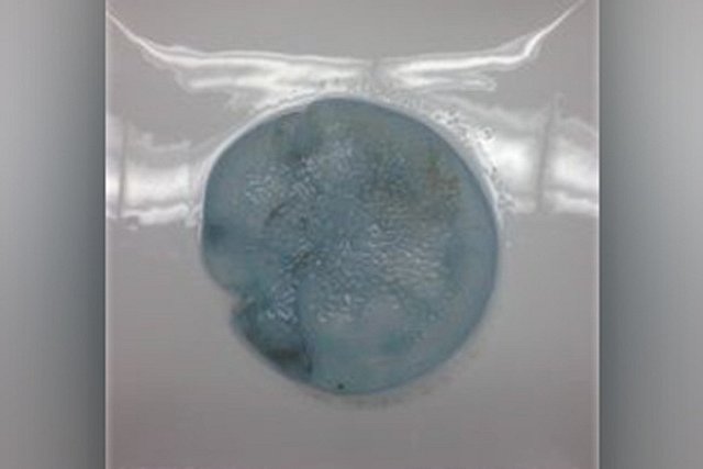 Австралиец принёс в полицию мёртвых медуз, решив, что это грудные импланты жертв