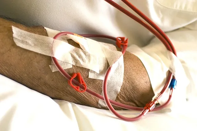 Прокуратура обеспечила жительнице Туринска трансфер на гемодиализ в Екатеринбург