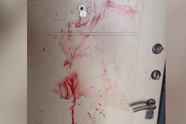 Екатеринбуржец разбудил друга, ударив ножом по спине