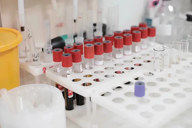 На Урале медики усилили контроль за лечением пациентов с хроническими психическими расстройствами