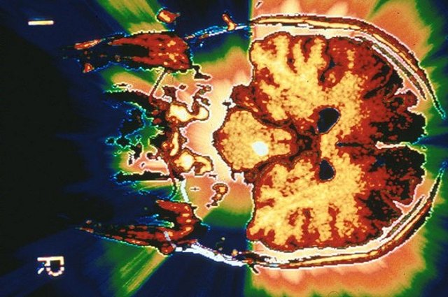 Новосибирские нейробиологи нашли «ген спланированной жестокости»