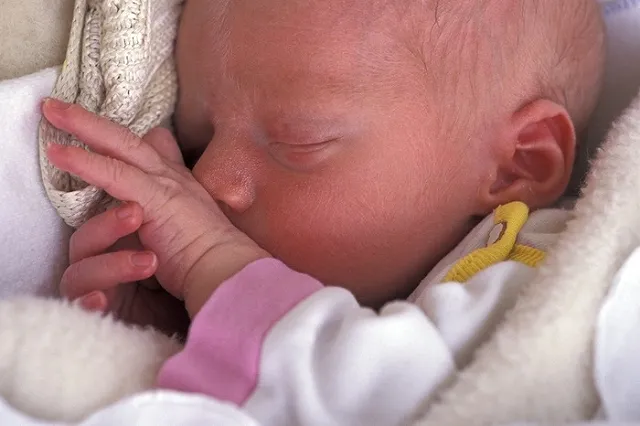 Младенца прооперировали через 12 часов после рождения и спасли ему жизнь