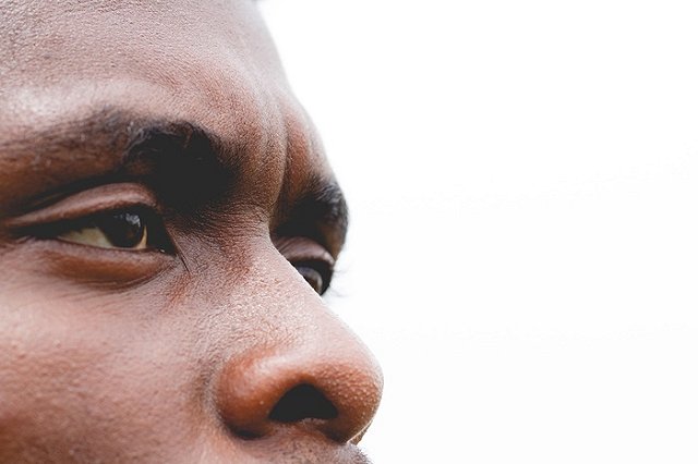 Зараженные коронавирусом мигранты покусали итальянских врачей