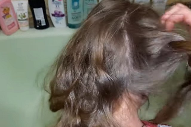 Санврачи назвали самый вшивый район Екатеринбурга