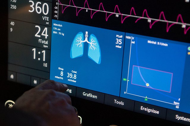 На Урал прибыла новая партия аппаратов ИВЛ. Их распределят по больницам в регионах