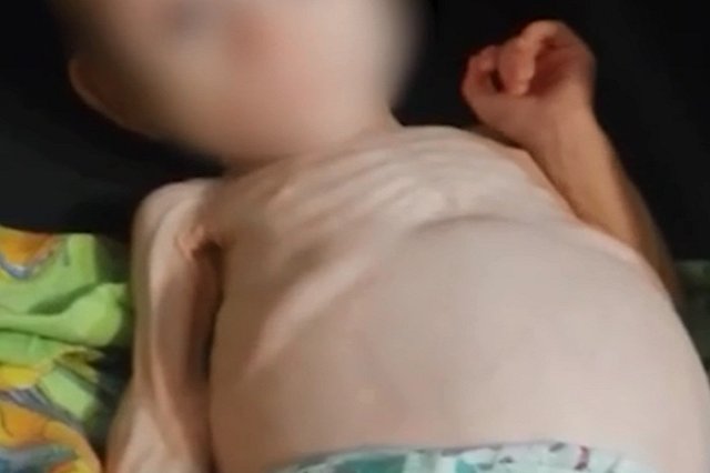 Женщина, державшая дочь в шкафу, научила своего старшего ребенка кормить сестру