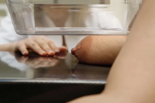 Певица Слава подкрепила свои слова об искусственном интеллекте, выявляющем рак