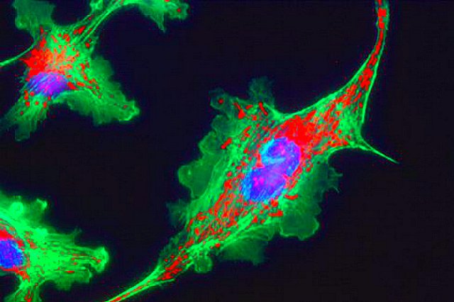 Американские ученые сообщили об обнаружении вируса глупости