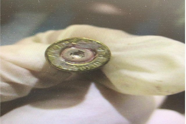 Полиция Екатеринбурга задержала стрелка, пытавшегося убить мужчину на улице Машинной