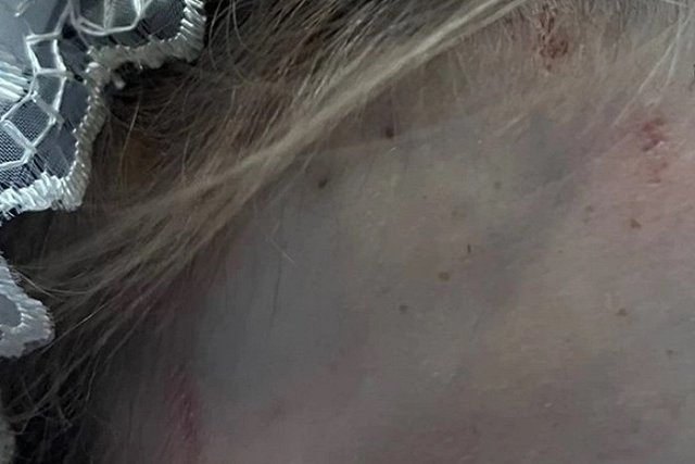 «Малахов» озвучил новую версию гибели 16-летней школьницы в Каменске-Уральском