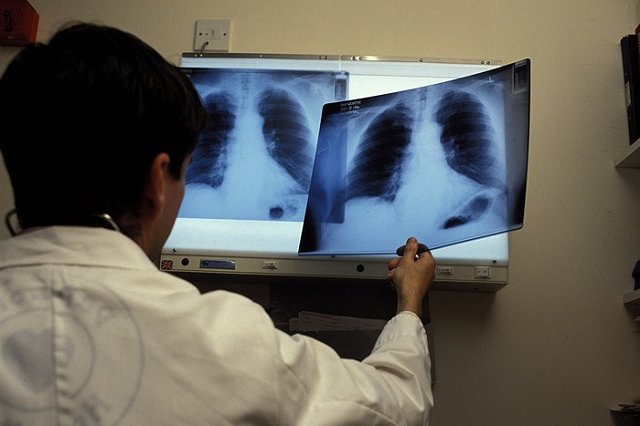 День борьбы с туберкулезом: медики приглашают горожан проверить здоровье