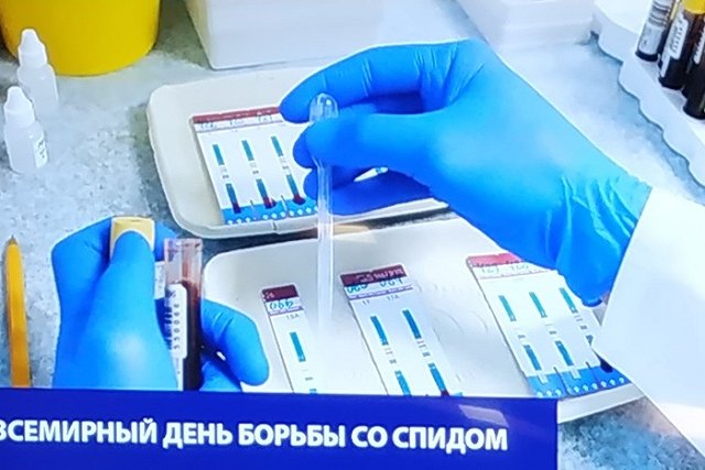 «Тестирование на ВИЧ должно войти в моду»: Всемирный день борьбы со СПИДом