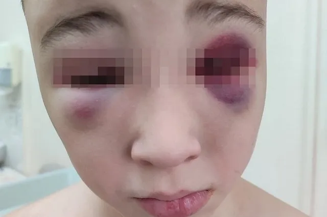 Россиянка обвинила участника спецоперации в избиении 10-летнего сына палками