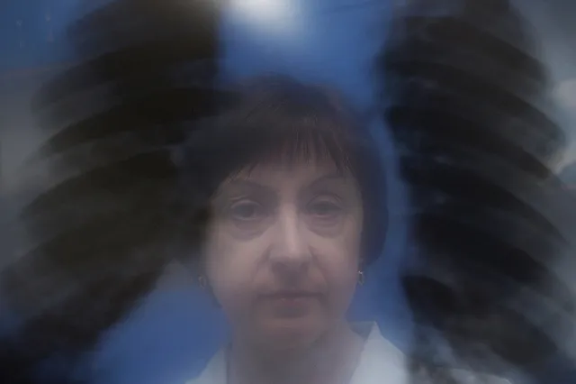 В субботу, 23 марта, в Екатеринбурге можно будет бесплатно пройти флюорографию